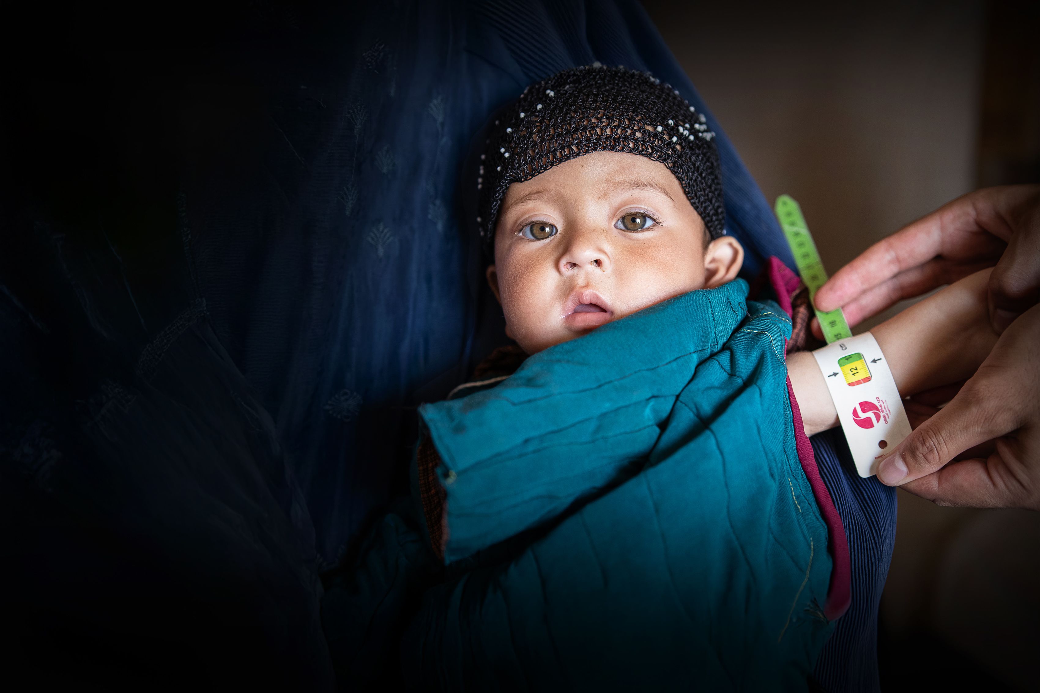 Arm measuring of a 16-month-old to screen for malnutrition